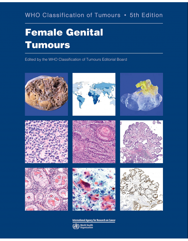 WHO Classification of Tumours Female Genital Tumors *US PAPERBACK* 5th Ed. - {9789283245049}  {9283245040}