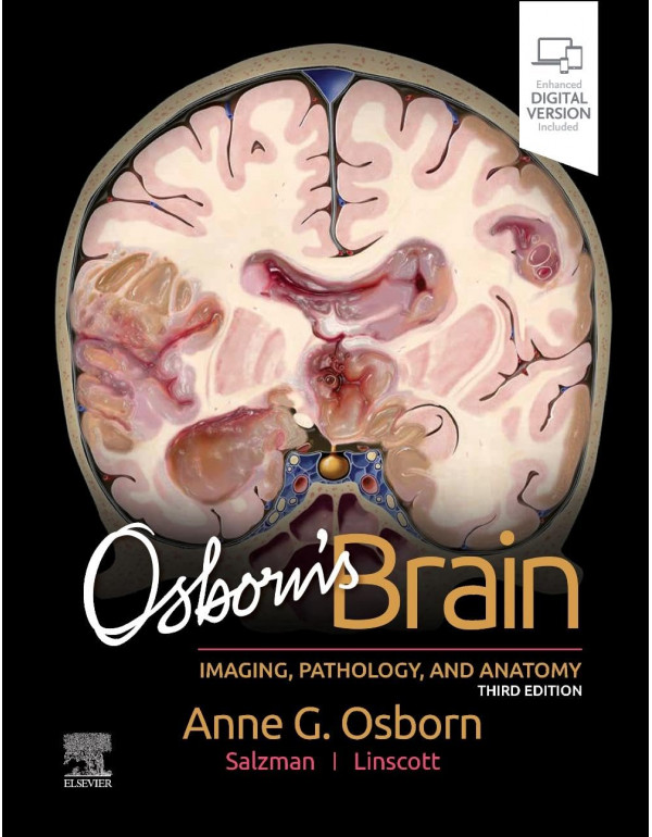 Osborn's Brain *US HARDCOVER* 3rd Ed. by Anne Osbo...