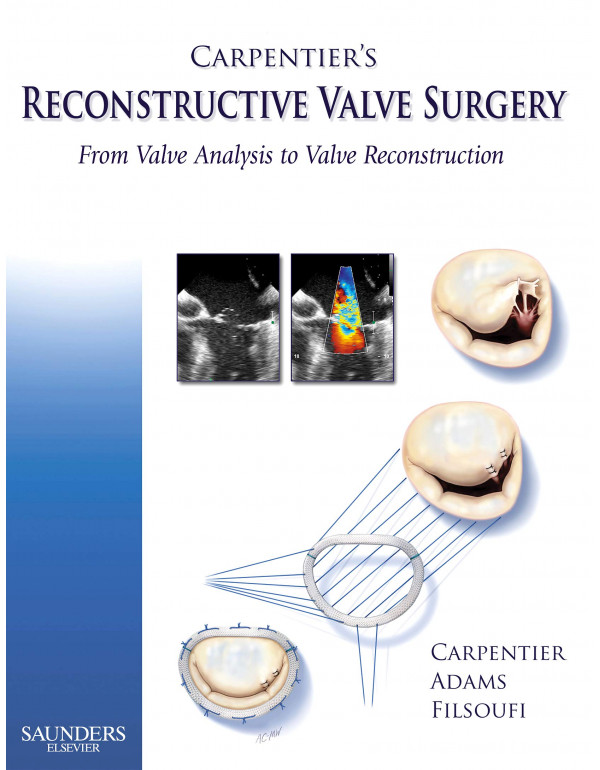 Carpentier's Reconstructive Valve Surgery *US HARDCOVER* by Alain Carpentier, David Adams - {9780721691688} {0721691684}