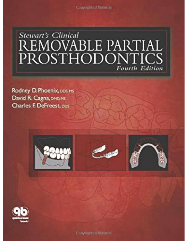 Stewart's Clinical Removable Partial Prosthodontics (Phoenix, Stewart's Clinical Removable Partial Prosthodontics) 4th Edition-9780867154856