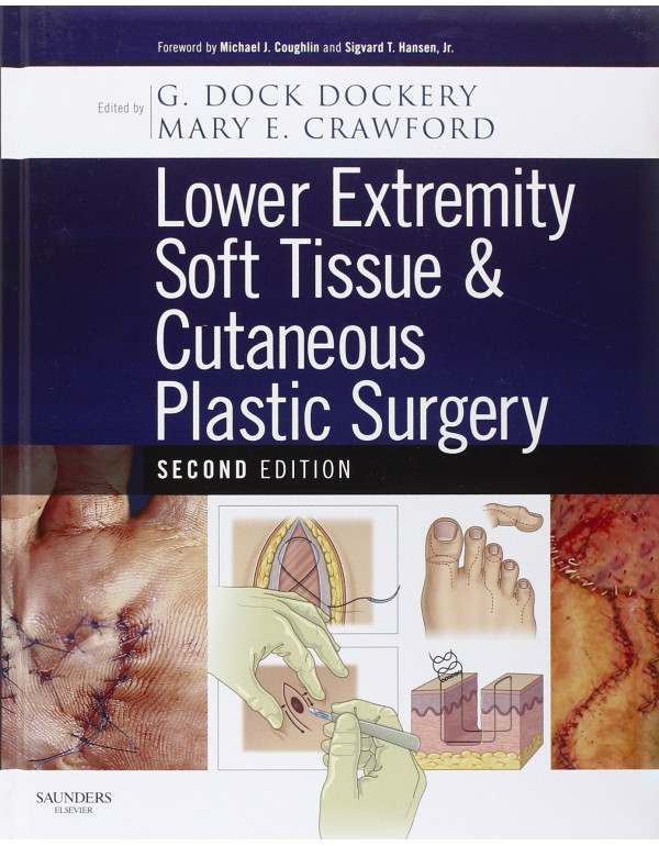 Lower Extremity Soft Tissue & Cutaneous Plastic Surgery *US HARDCOVER* 2nd Ed. by G Dock Dockery, Mary Elizabeth Crawford - {9780702031366} {0702031364}